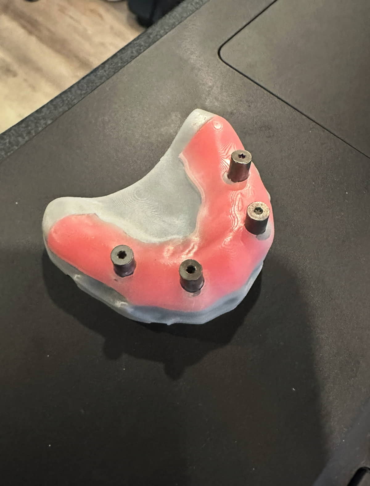 Dentist Offers All-on-X in New Jersey